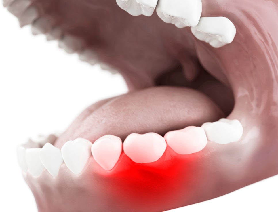 Gangseo-gu Hwagok Dental Clinic: Why Toothache Gets Worse at Night image 3