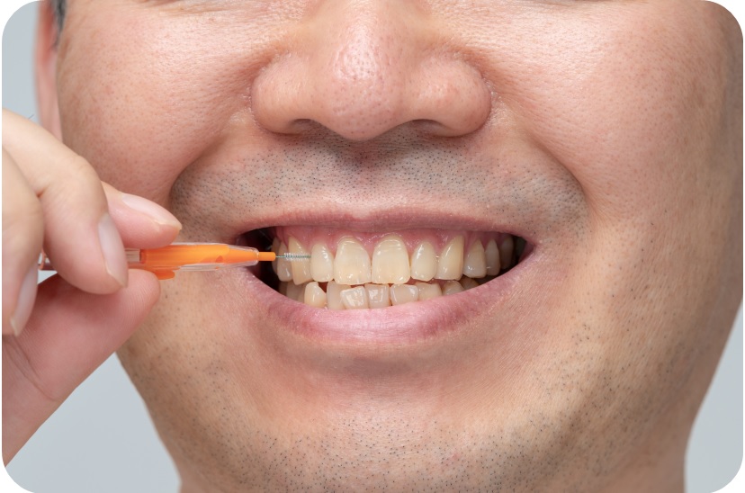 발산전체임플란트, 오래가는 분들의 공통점은? 관련 이미지 4