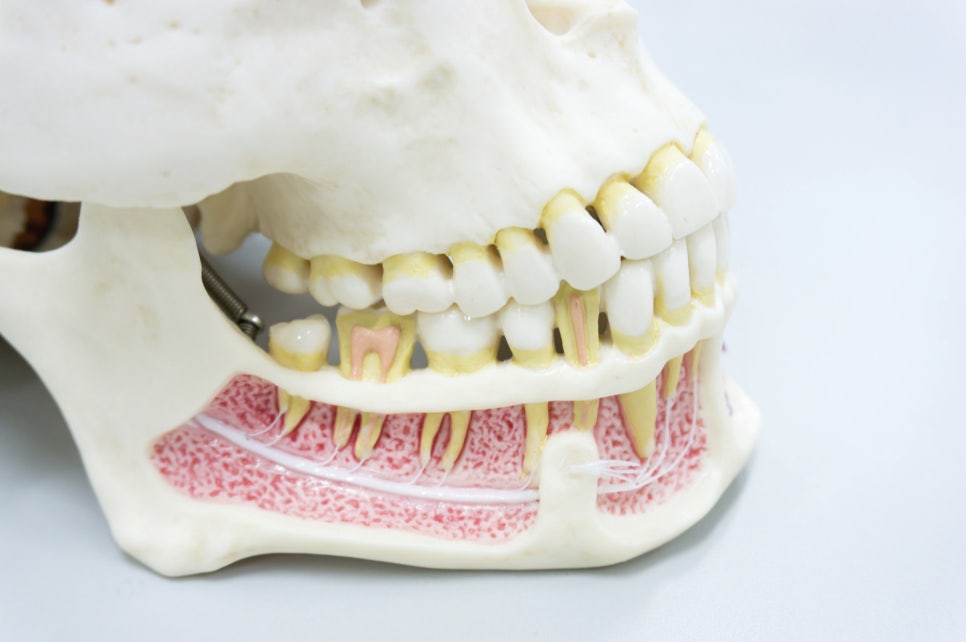 우장산역치과, 임플란트 부작용 미리 예방하세요 관련 이미지 5