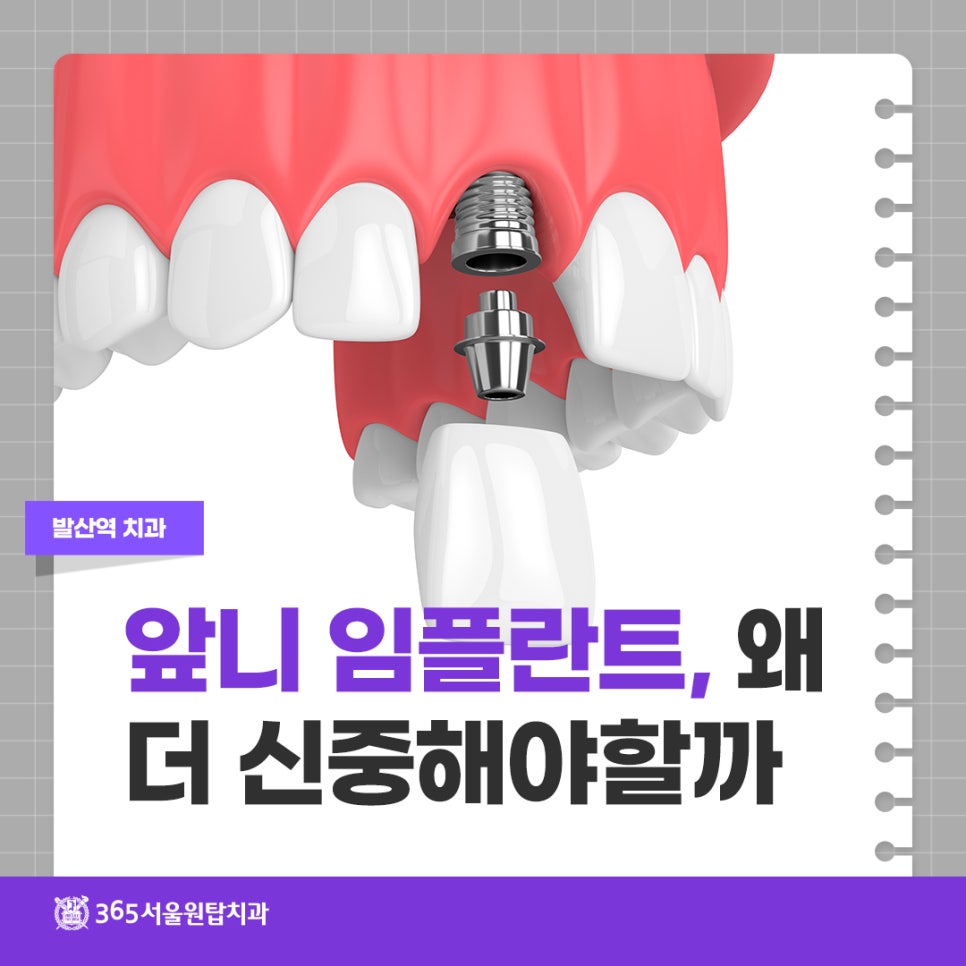 발산역치과 앞니 임플란트, 왜 더 신중해야 할까 관련 이미지 10