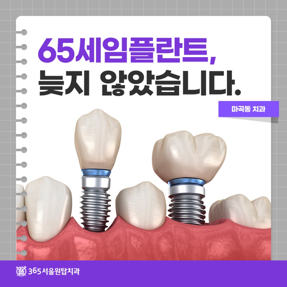 마곡동치과 65세임플란트, 아직 늦지 않았습니다 관련 이미지 11