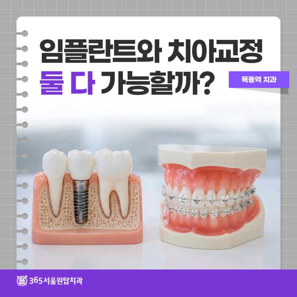 목동역치과, 임플란트와 치아교정 둘 다 가능할까? 관련 이미지 8