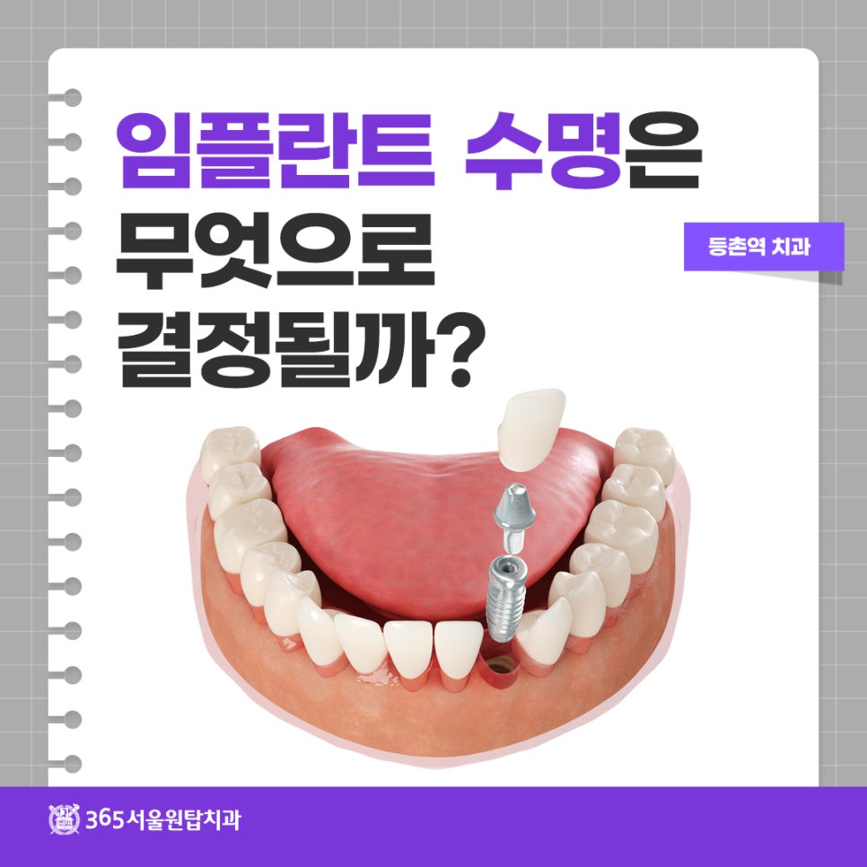 등촌역치과, 임플란트 수명은 무엇으로 결정될까? 관련 이미지 10