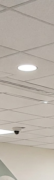 화곡역치과 치아가 빠진 개수만큼 임플란트를 심어야 될까? 관련 이미지 19