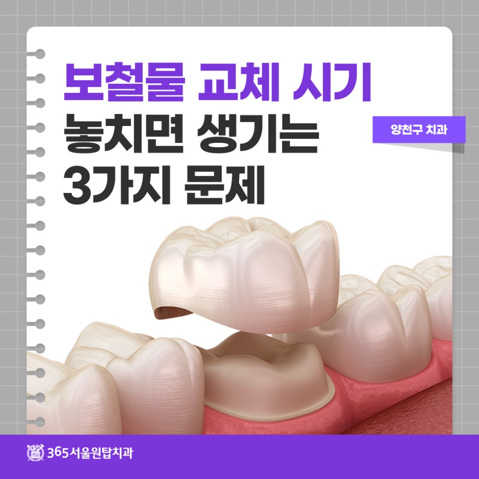 Yangcheon-gu Dental Clinic: 3 Problems That Can Occur If You Miss the Time to Replace Dental Prostheses image 9