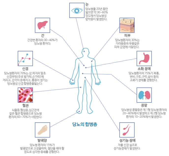우장산치과 당뇨가 있어도 임플란트 가능할까요? 관련 이미지 6