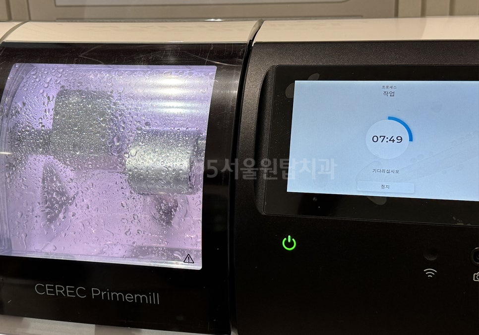 강서구 보철치과, Primemill (프라임밀) 장비를 선택한 이유 관련 이미지 4