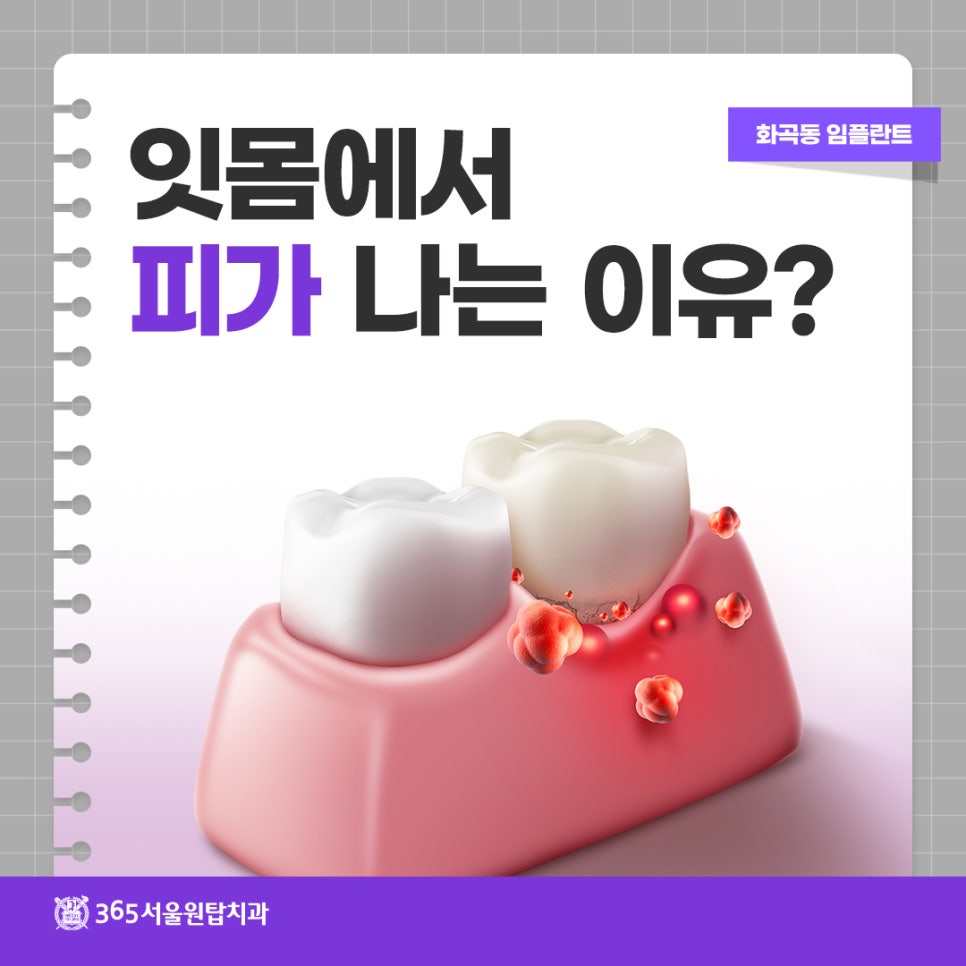 화곡동 임플란트, 잇몸에서 피가 나는 이유? 관련 이미지 8