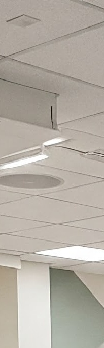 화곡역치과 치아가 빠진 개수만큼 임플란트를 심어야 될까? 관련 이미지 18