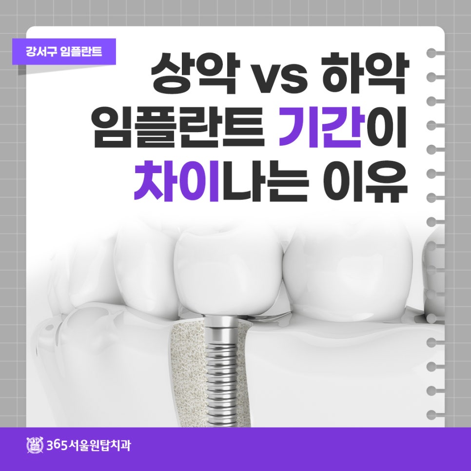 강서구 임플란트, 상악 vs 하악 치료 기간이 차이 나는 이유 관련 이미지 6