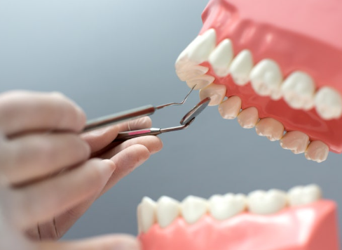 신월동치과 임플란트 심는 자리만 보면 안 되는 이유 관련 이미지 9