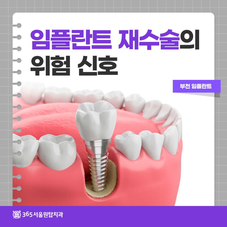 부천임플란트, 임플란트 재수술의 위험 신호 관련 이미지 10
