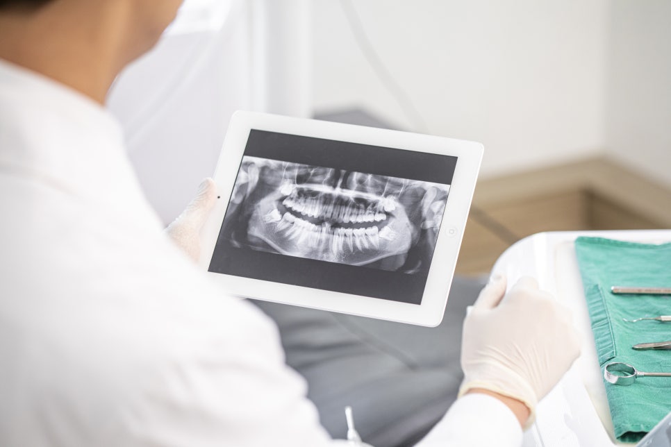 Yangcheon-gu Dental Clinic: 3 Problems That Can Occur If You Miss the Time to Replace Dental Prostheses image 8