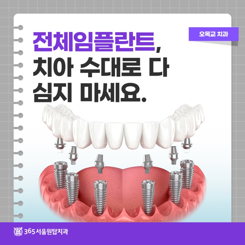 오목교치과, 전체임플란트 개수는 몇 개가 적당할까? 관련 이미지 9