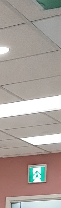 화곡역치과 치아가 빠진 개수만큼 임플란트를 심어야 될까? 관련 이미지 24