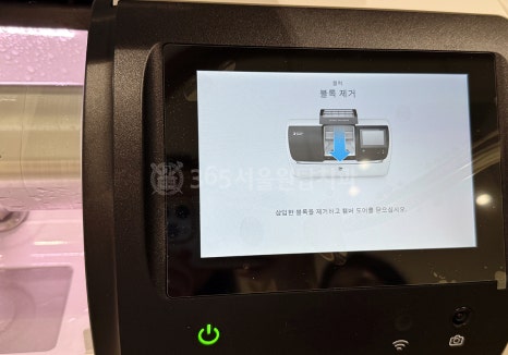 강서구 보철치과, Primemill (프라임밀) 장비를 선택한 이유 관련 이미지 10