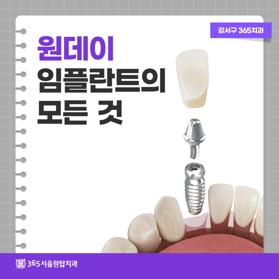 강서구 365치과, 원데이 임플란트의 모든 것 관련 이미지 9