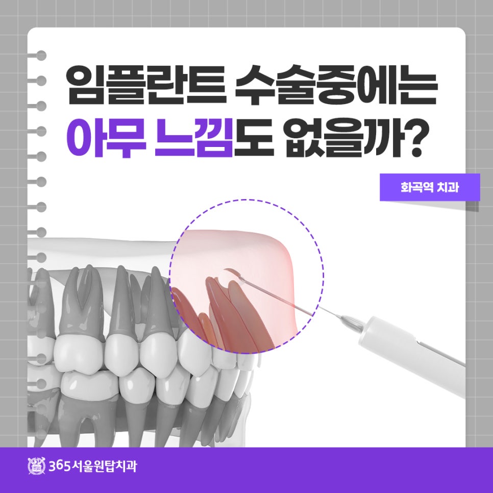 화곡역치과, 임플란트 수술중에는 아무 느낌도 없을까? 관련 이미지 5