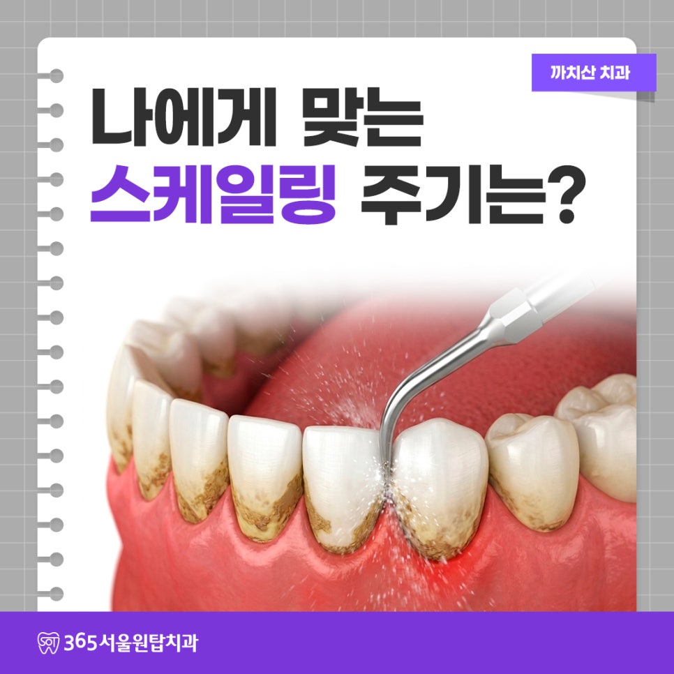 까치산치과, 나에게 맞는 스케일링 주기는? 관련 이미지 6