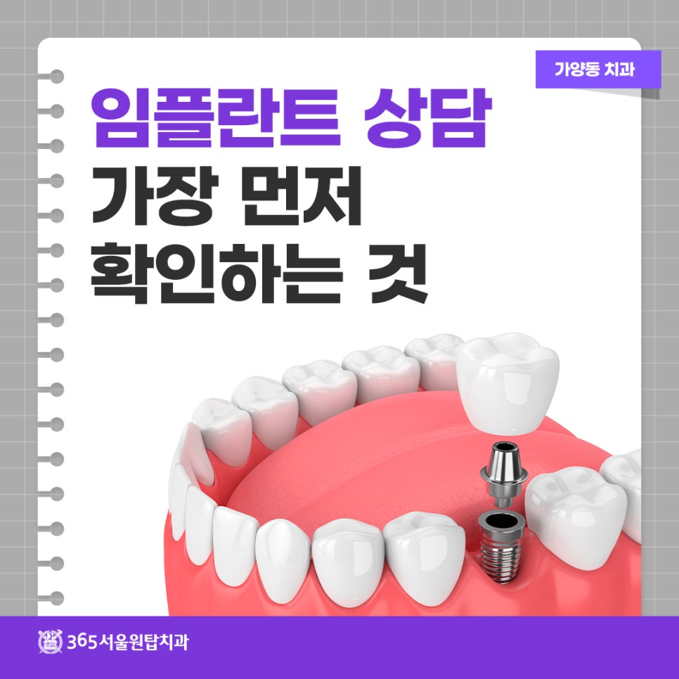 가양동치과 임플란트 상담, 제가 가장 먼저 확인하는 것 관련 이미지 8