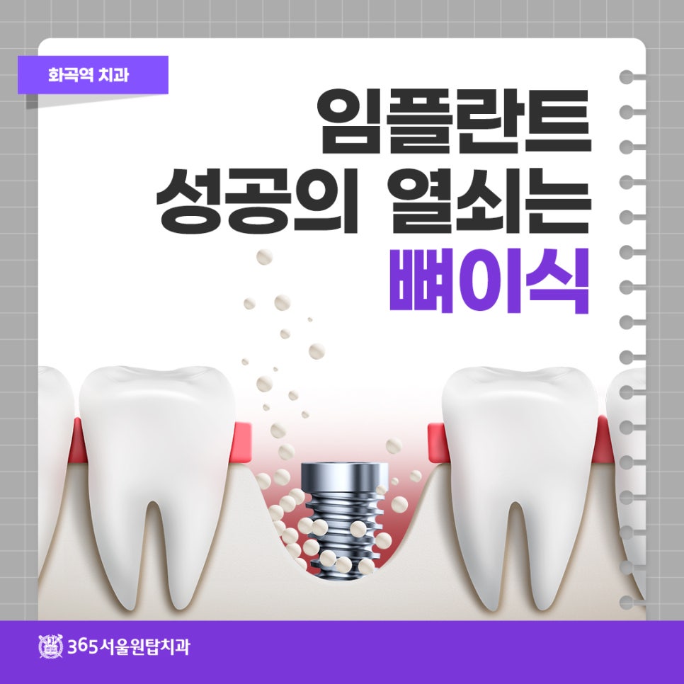 화곡역치과, 임플란트 성공의 열쇠는 뼈이식 관련 이미지 10
