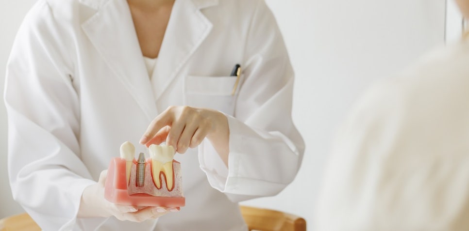 신월동치과 부모님 임플란트, 어떤 기준으로 치료할까 관련 이미지 7