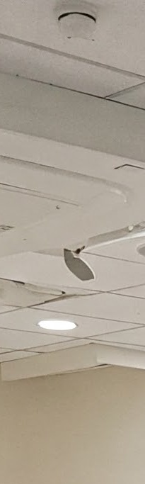 화곡역치과 치아가 빠진 개수만큼 임플란트를 심어야 될까? 관련 이미지 17