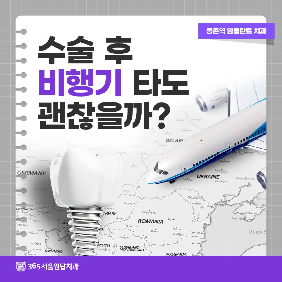 등촌역임플란트치과 수술 후 비행기 타도 괜찮을까? 관련 이미지 8