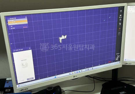 강서구 보철치과, Primemill (프라임밀) 장비를 선택한 이유 관련 이미지 6