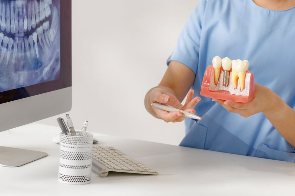 김포공항 근처 치과에서 알아보는 임플란트 vs 브릿지 차이점 관련 이미지 2