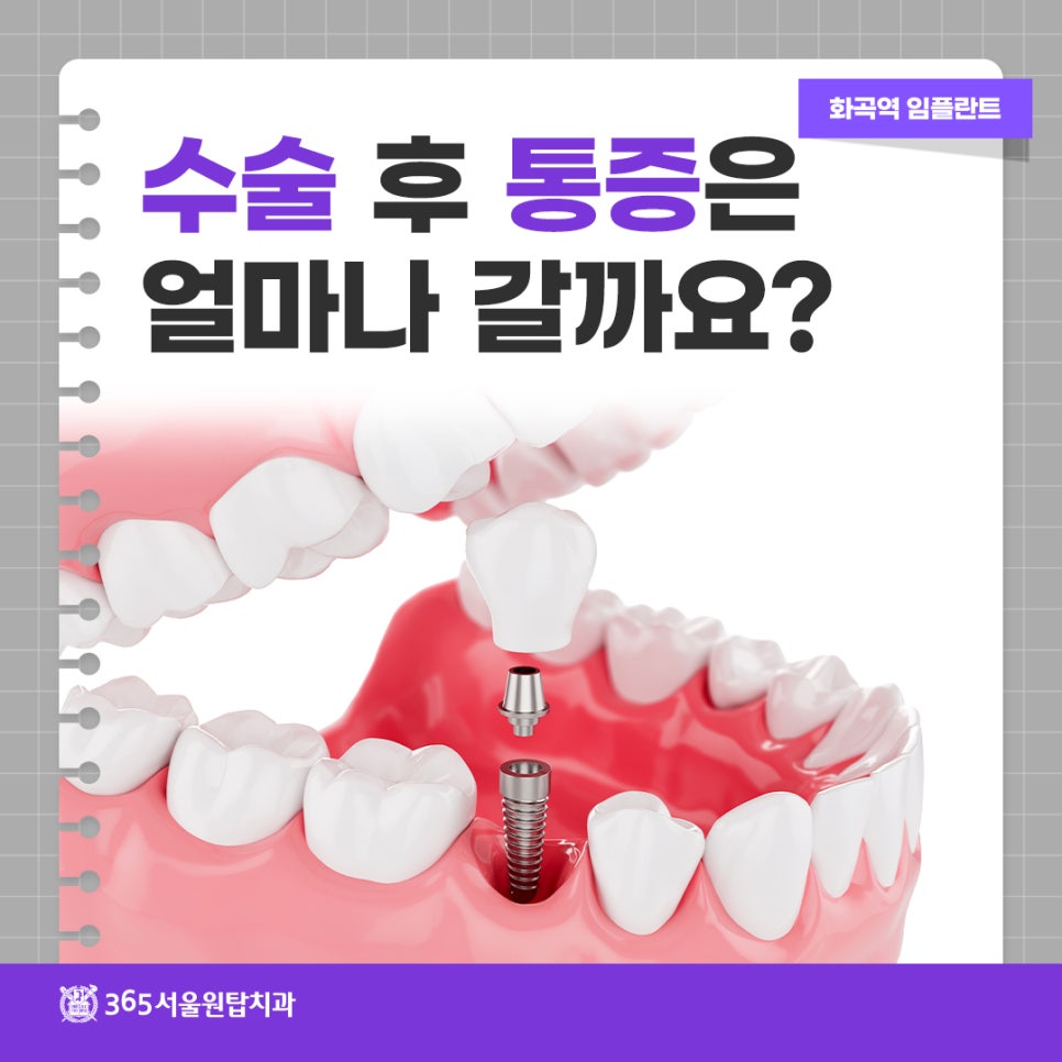 화곡역임플란트 수술 후 통증은 얼마나 갈까요? 관련 이미지 10