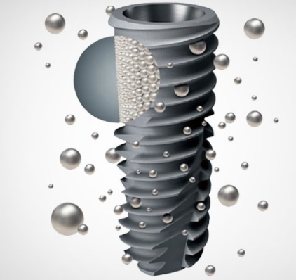 우장산치과 당뇨가 있어도 임플란트 가능할까요? 관련 이미지 8