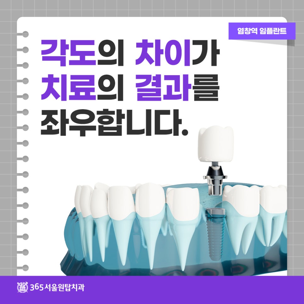 염창역 임플란트, 식립 각도의 차이가 치료 결과를 좌우합니다 관련 이미지 8