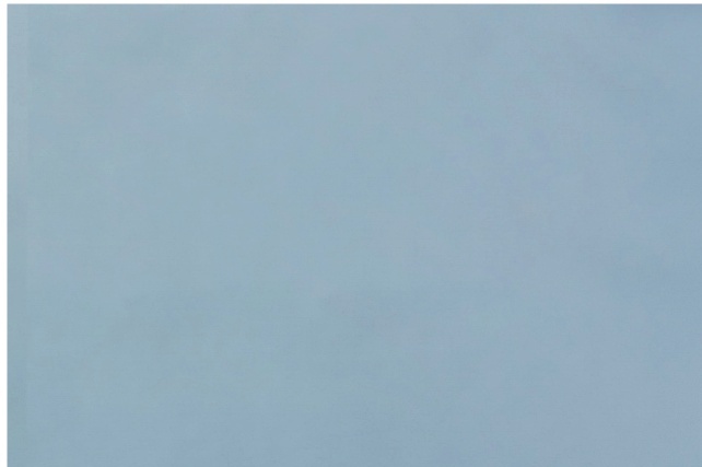 눈매교정술 눈이 잘 안 떠진다면 먼저 확인해야 할 것이 있습니다 관련 이미지 16