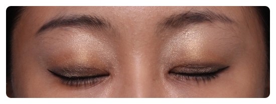 [안병준의 눈이야기]-안병준 성형외과 관련 이미지 7