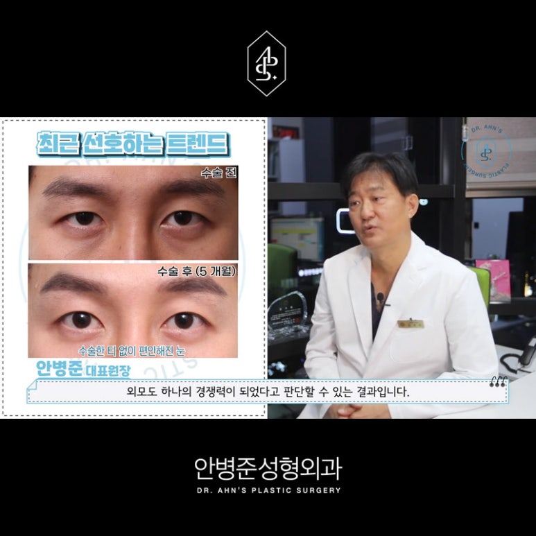 [남자성형외과] 남자 눈성형 쌍꺼풀수술 사례 모음 관련 이미지 6