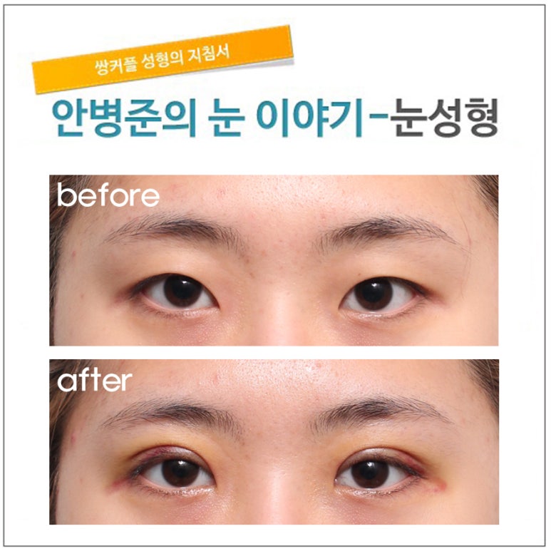 동양적인 눈(몽고주름,짝짝이눈) 관련 이미지 1