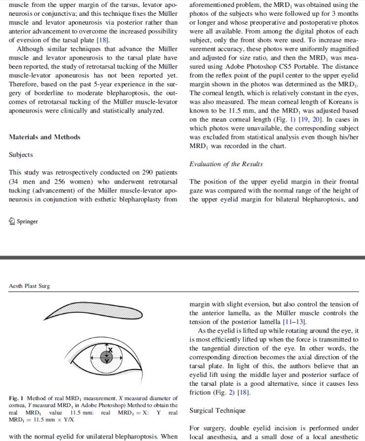 시크릿성형외과 안병준 원장의 눈매교정 유럽학회발표 관련 이미지 3