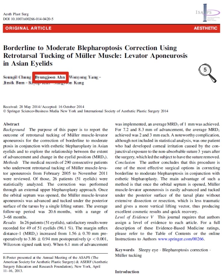 시크릿성형외과 안병준 원장의 눈매교정 유럽학회발표 관련 이미지 1