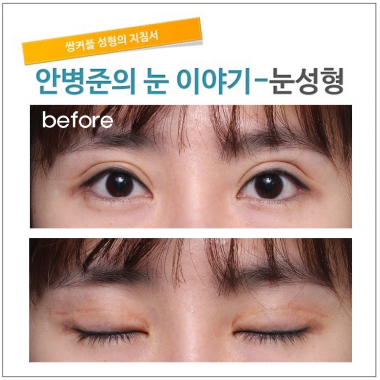 첫수술의 중요성! [재건] 관련 이미지 1