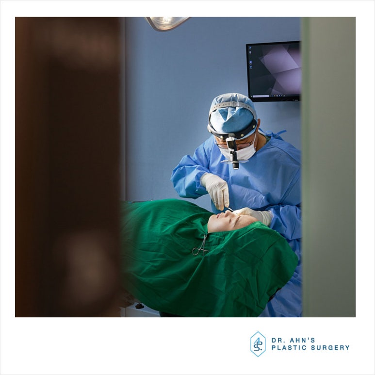 삼백안 교정 수술로 자연스럽고 편안한 눈매 완성~! 관련 이미지 3