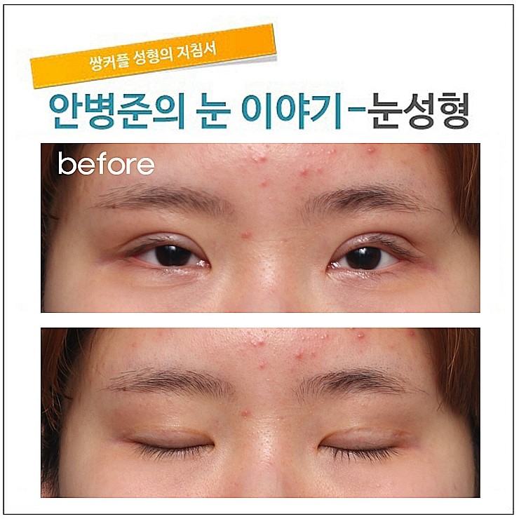 첫수술의 중요성! [재건] 관련 이미지 2