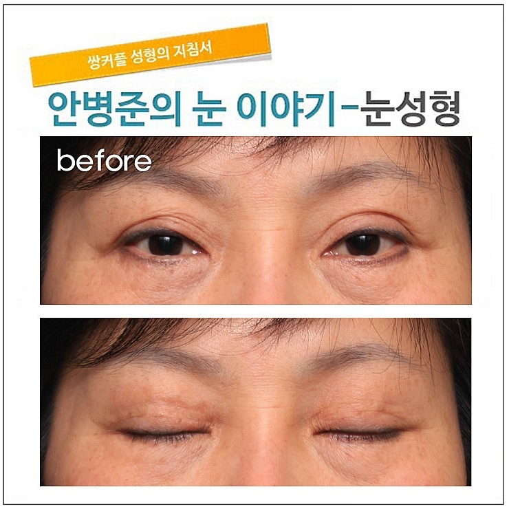 첫수술의 중요성! [재건] 관련 이미지 3