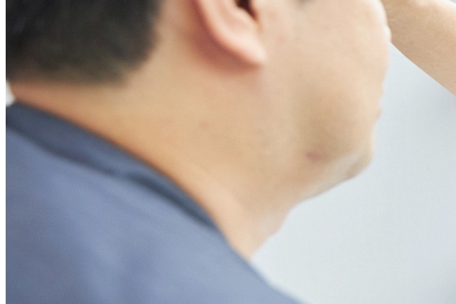 상하안검수술 눈 위아래를 함께 보는 이유 관련 이미지 11