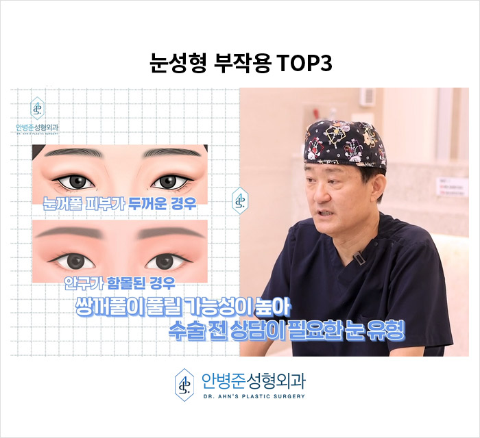 [눈재수술] 짝짝이&middot;풀어짐&middot;불만족, 쌍꺼풀 부작용과 예방 방법은? 관련 이미지 6