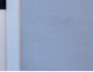 여자 눈매교정 안검하수 또렷하면서도 부드러운 인상을 찾다 관련 이미지 8