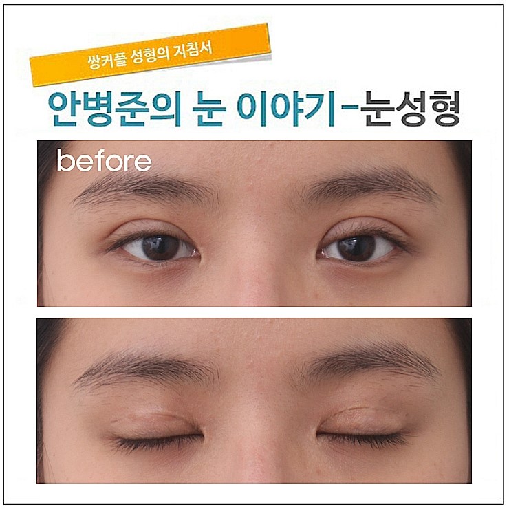 첫수술의 중요성! [재건] 관련 이미지 4