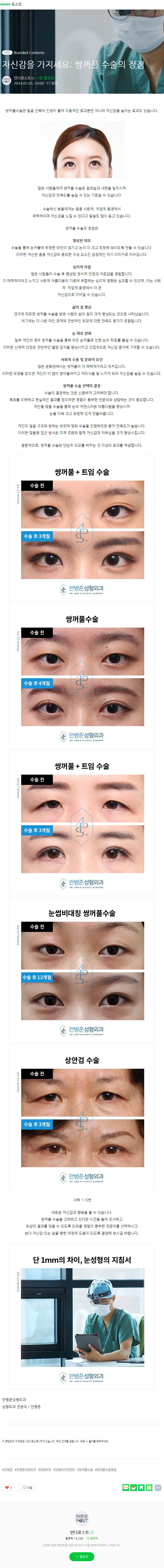 [네이버포스트] 자신감을 가지세요: 쌍꺼풀 수술의 장점 관련 이미지 2