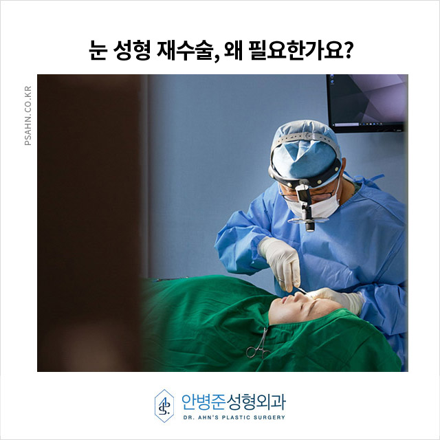 [재수술성형외과] 눈 성형 재수술, 왜 필요한가요? 관련 이미지 1