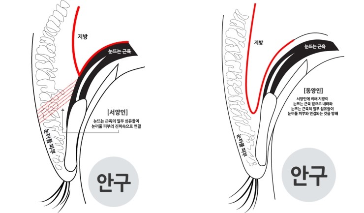 안병준의 쌍꺼풀 지침서 11_ 동양인과 서양인의 눈꺼풀 구조의 차이점. 관련 이미지 1